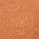 Human Osteoblasts: Osteoarthritis: HOb-OA