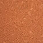 Human Osteoblasts: Rheumatoid Arthritis: HOb-RA