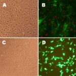 Human Pulmonary Artery Endothelial Cells: Asthma: S-HPAEC-AS: Pre-Screened