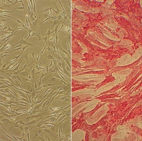 Human Pulmonary Artery Smooth Muscle Cells: HPASMC