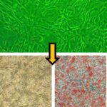 Human Preadipocytes: Asthma: HPAd-AS
