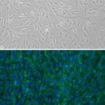 Human Pericardial Fibroblasts: HPcF
