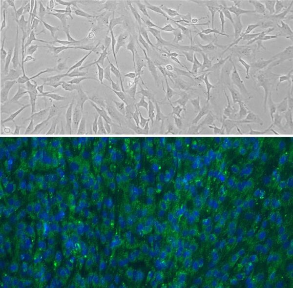 Human Pericardial Fibroblasts: HPcF