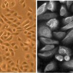 Human Prostate Epithelial Cells: HPrEpC
