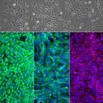 Human Renal Glomerular Epithelial Cells: HRGEpC