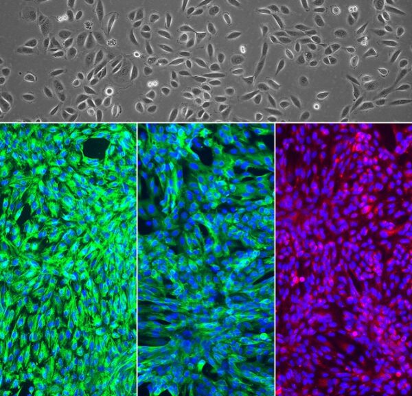 Human Renal Glomerular Epithelial Cells: HRGEpC