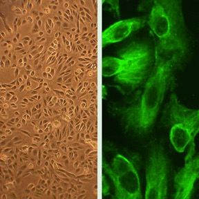Human Renal Proximal Tubular Epithelial Cells: HRPTEpC