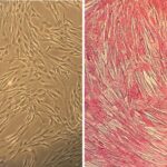 Human Subclavian Artery Smooth Muscle Cells: HScASMC