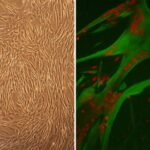 Human Skeletal Muscle Cells: HSkMC