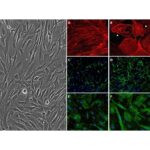 Human Trabecular Meshwork Cells: HTMC