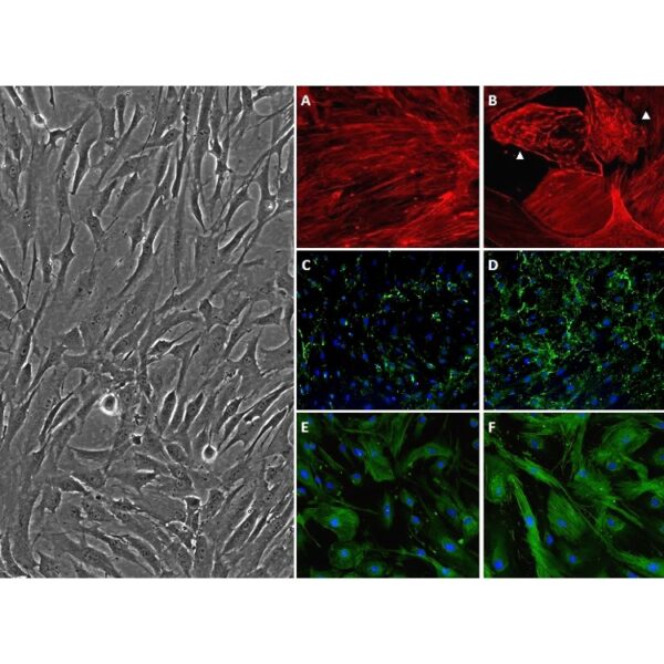 Human Trabecular Meshwork Cells: HTMC