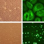 Human Urethra Epithelial Cells: HUEpC