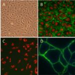 Human Umbilical Vein Endothelial Cells: HUVEC