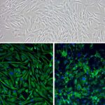 Human Corneal Keratocytes: HCK