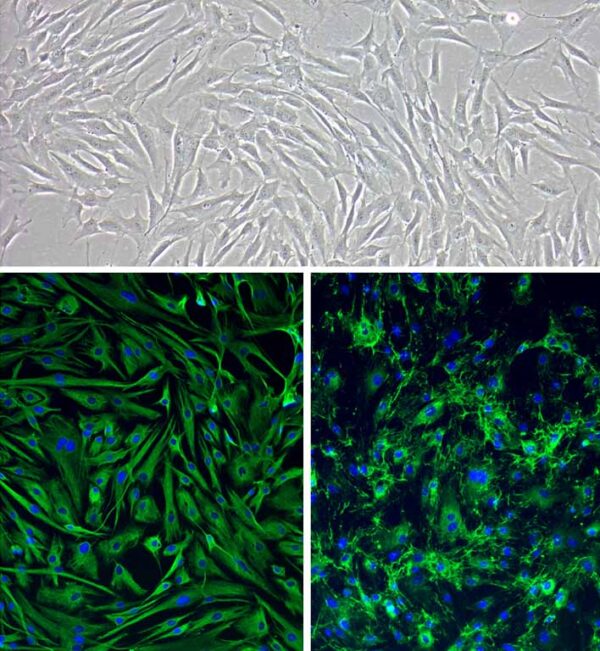Human Corneal Keratocytes: HCK