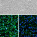 Human Gall Bladder Fibroblasts: HGBF