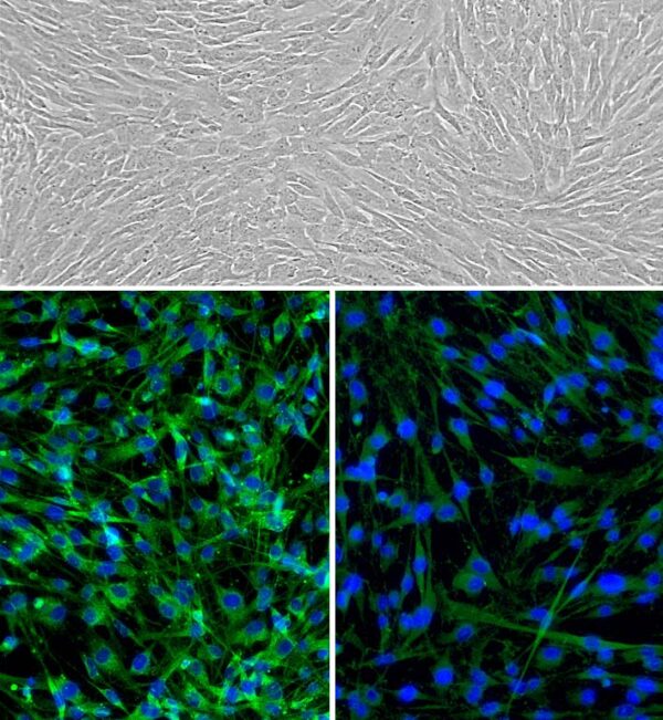 Human Gall Bladder Fibroblasts: HGBF
