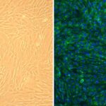Human Hepatic Duct Fibroblasts: HHDF