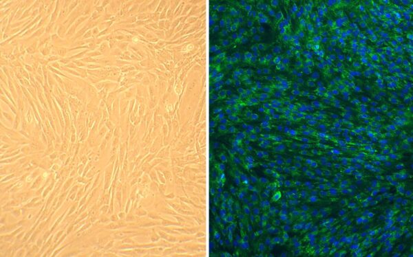 Human Hepatic Duct Fibroblasts: HHDF