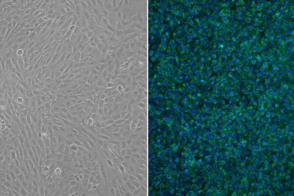 Human Hepatic Fibroblasts: HHF