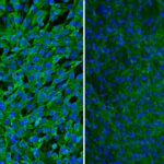 Human Hepatic Stellate Cells: HHSC