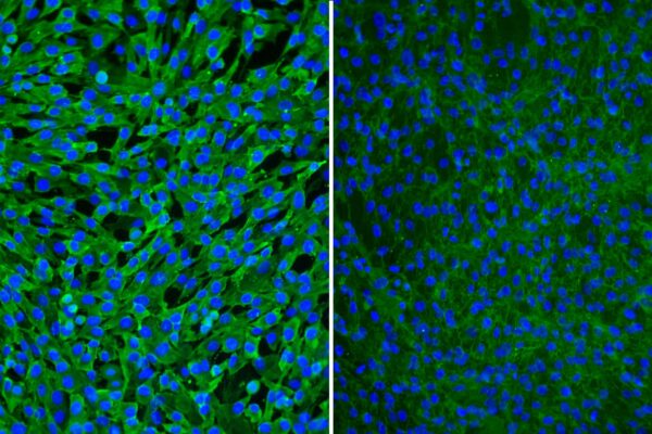 Human Hepatic Stellate Cells: HHSC
