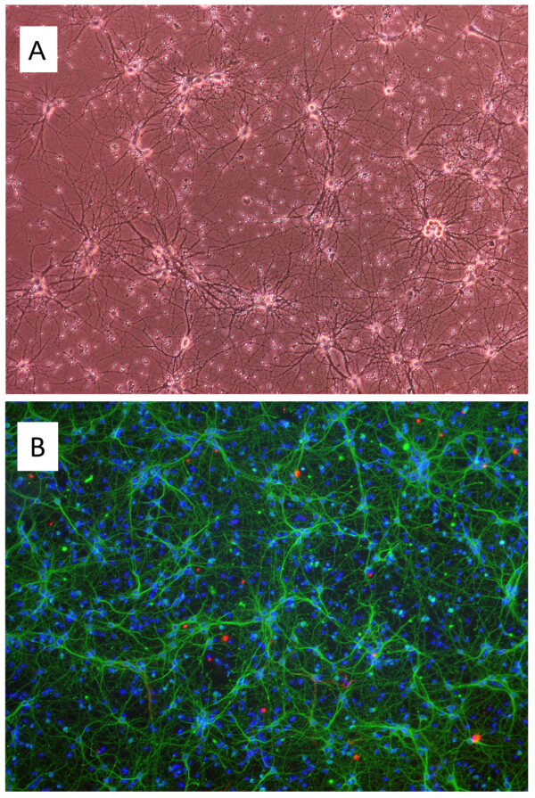 Mouse Cortical Neurons: MCoN