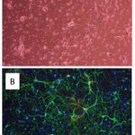 Mouse Striatal Neurons: MStN