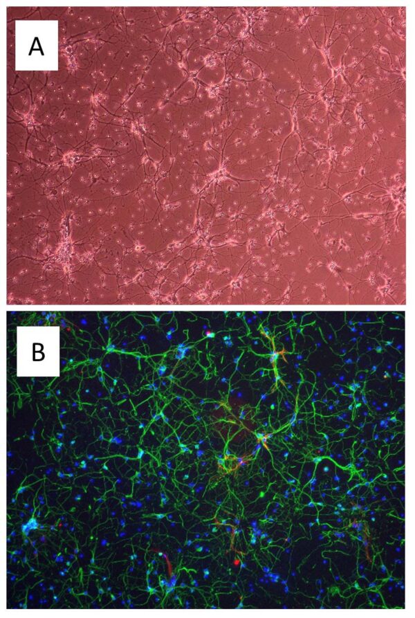 Mouse Striatal Neurons: MStN