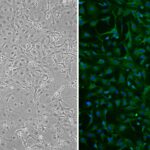 Mouse Hepatic Stellate Cells: MHSC