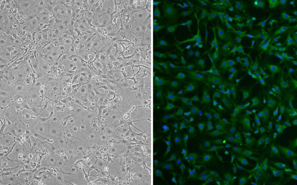 Mouse Hepatic Stellate Cells: MHSC