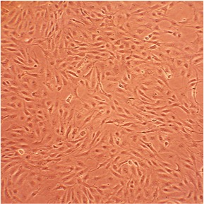 Porcine Aortic Endothelial Cells: PAOEC