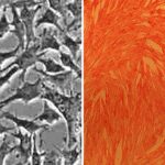 Porcine Aortic Smooth Muscle Cells: PAOSMC