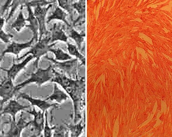 Porcine Aortic Smooth Muscle Cells: PAOSMC