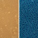 Porcine Coronary Artery Endothelial Cells: PCAEC