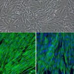 Porcine Cardiac Valve Interstitial Cells: PCVIC