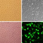 Porcine Pulmonary Artery Endothelial Cells: PPAEC