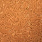 Porcine Pulmonary Artery Smooth Muscle Cells: PPASMC