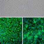 Porcine Corneal Keratocytes: PCK