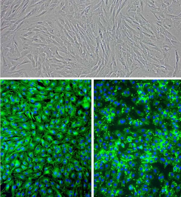 Porcine Corneal Keratocytes: PCK
