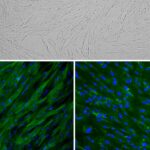 Porcine Trabecular Meshwork Cells: PTMC