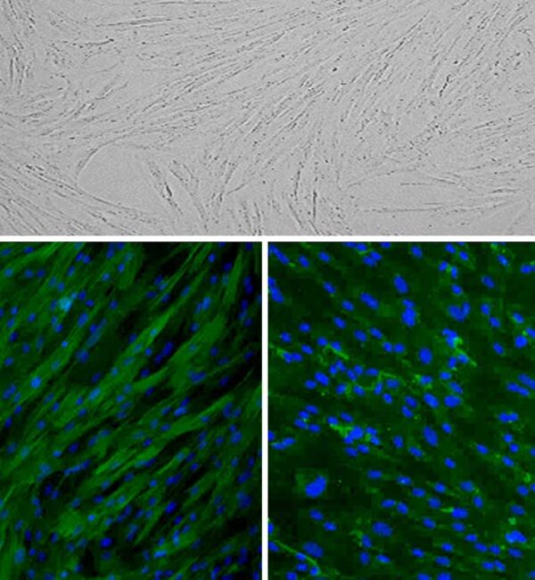 Porcine Trabecular Meshwork Cells: PTMC
