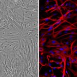 Rat Astrocytes: RA