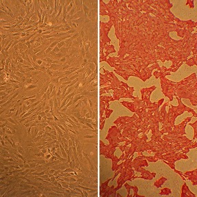 Rat Aortic Smooth Muscle Cells: RAOSMC