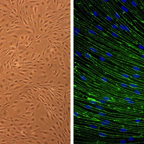 Rat Brain Microvascular Endothelial Cells: RBMVEC