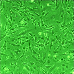 Rat Cardiac Fibroblasts: RCF