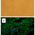 Rat Cerebellar Astrocytes: RCeA