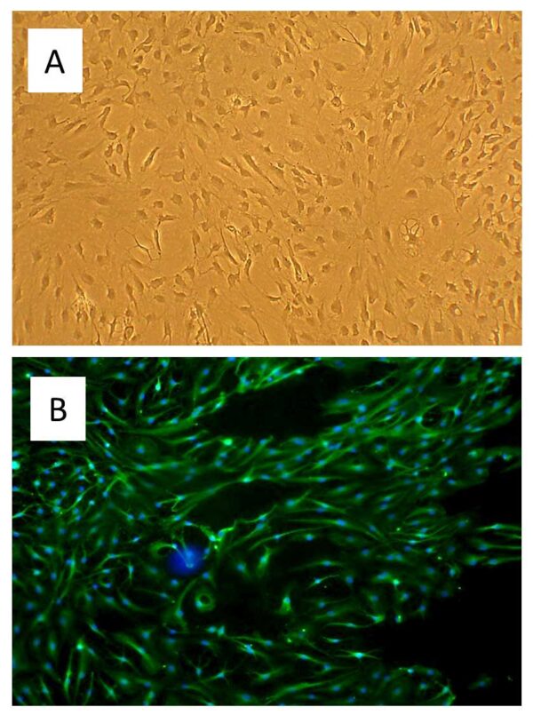 Rat Cerebellar Astrocytes: RCeA