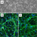 Rat Cortical Neurons: RCoN