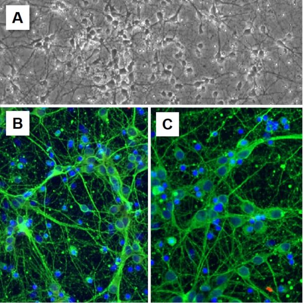 Rat Cortical Neurons: RCoN